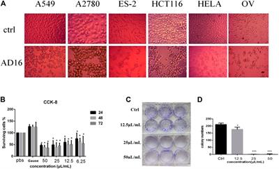 Dissection of the Functional Mechanism of Human Gut Bacterial Strain AD16 by Secondary Metabolites’ Identification, Network Pharmacology, and Experimental Validation